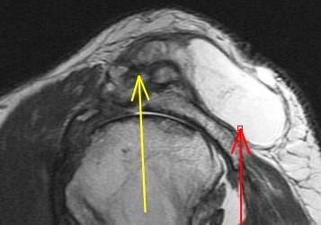 Figure 6 for case Geyser phenomenon